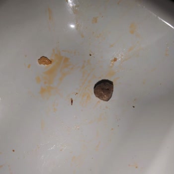 Erünal Sosyal Bilimler Lisesi Sosyal Bilimler Lisesi Yurt Yemeklerindeki Hijyen Sorunları