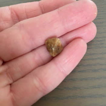 Migros Paket İçerisinden Çıkan Beklenmedik Madde