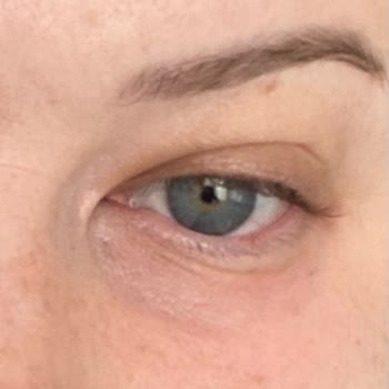 Garnier Göz Makyajı Temizleyici Hasar Verdi Ve Elimde Kaldı