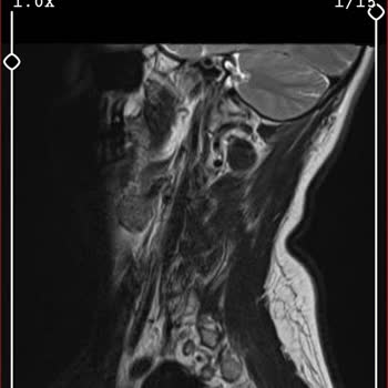 Pluss Fit Elite Spor Salonu Üyeliği Dondurma Sorunu