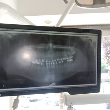 Estetica Dental Diş Tedavisinde Büyük Hüsran!