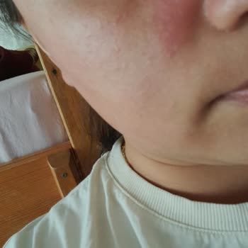 BİM Ve Sattığı Claderm Maskesi