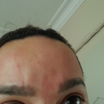 BİM Ve Sattığı Claderm Maskesi