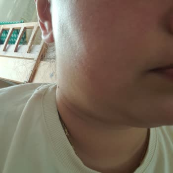 BİM Ve Sattığı Claderm Maskesi