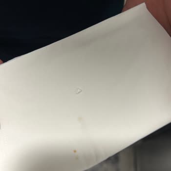 Trendyol Börek Siparişinde Cam Parçası Bulunması