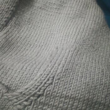 Etrofil Renk Değişikliği Yaşanan İplik Paketi Ve Örgü Hayal Kırıklığı