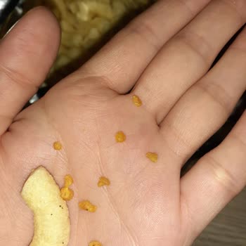 Cheetos Çıtırcık İçinde Sert Şeyler Çıkıyor Yerken