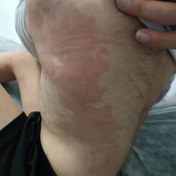 Atabay İlaç Firması Enfluvir Şurup Çocuğuma Yaptıkları