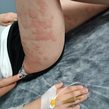 Atabay İlaç Firması Enfluvir Şurup Çocuğuma Yaptıkları