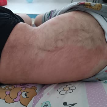 Atabay İlaç Firması Enfluvir Şurup Çocuğuma Yaptıkları