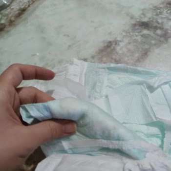Molfix Bezinde Çıkan Şeyler