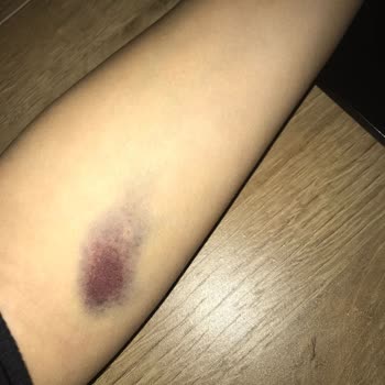 A Life Hospital A Life Ticarethane