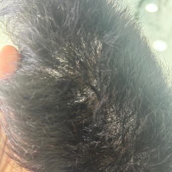 Hair Life Protez Saç Hüsranı: Kalitesiz Ürün Ve Hizmet