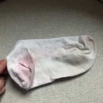 SuperStep Mağazasının Renk Veren Ugg Ları İade Almaması