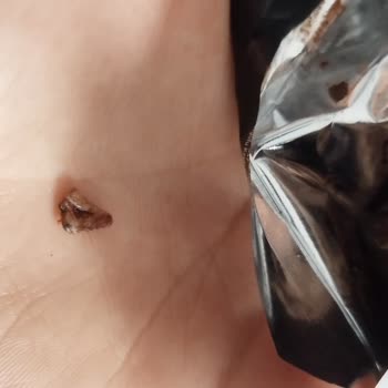 Eti Gıda Eti Karam Tanımlanamayan Sert Cisim