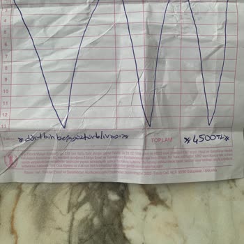 YEDAŞ Planlı Kesinti Yüksek Voltaj