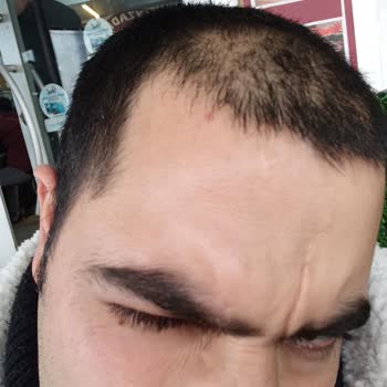 Bioxin Den Şikayetçiyim