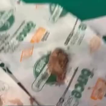Ekrem Coşkun Döner Çiği Olması Ve Pişmemiş Olması!
