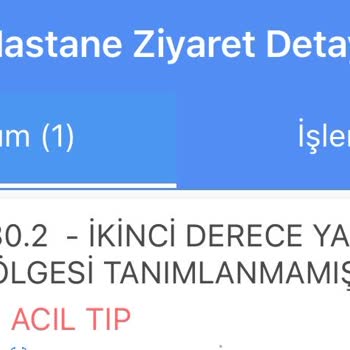 Nova Güzellik Salonu (Antalya) Lazer Sonucu 2. Derece Yanık