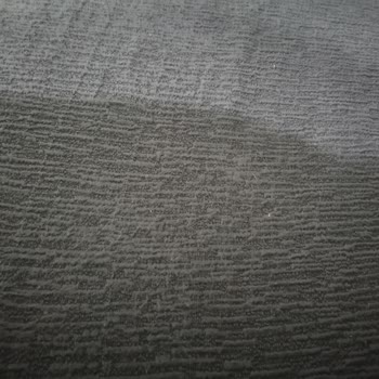 Nisaninkoltuk.ortuleri (Instagram) Tüylenme Olması