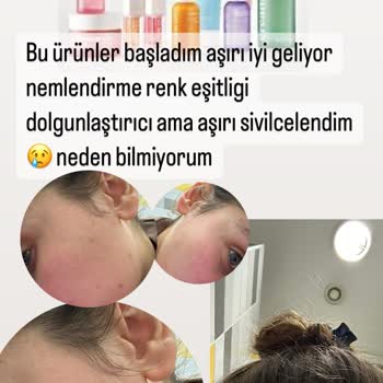 Cream Co. Ürünlerini Kullandım Yüzümde Ciddi Dökülme Oldu