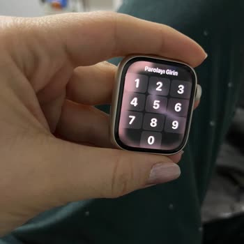 Teknosa Apple Watch Ekranında Sıkıntı Var!?
