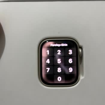 Teknosa Apple Watch Ekranında Sıkıntı Var!?