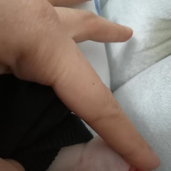 Biruni Üniversitesi Hastanesi Hastane Hizmetleri Yetersiz Kaldı