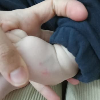 Biruni Üniversitesi Hastanesi Hastane Hizmetleri Yetersiz Kaldı