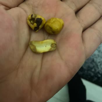 Çitlekçi Karışık Çerezden Çıkan Ürünler