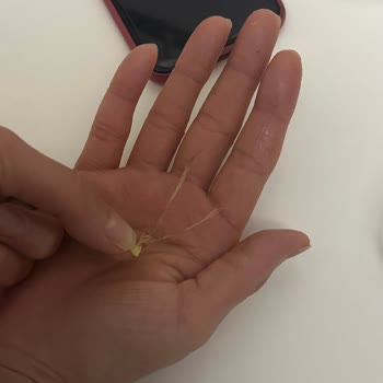 Lays Klasik Cips Yabancı Cisim