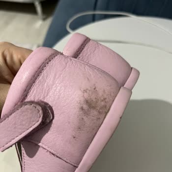 Kifidis Ayakkabıda Yaşadığım Problem Hk