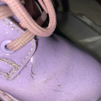 Deichmann Çocuk Botunda Garanti Kapsamı Sorunu