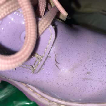 Deichmann Çocuk Botunda Garanti Kapsamı Sorunu