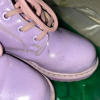 Deichmann Çocuk Botunda Garanti Kapsamı Sorunu