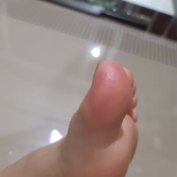 Hepsiburada Sağlıksız Yara Yapan Botlar