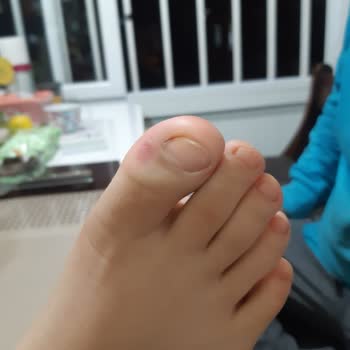 Hepsiburada Sağlıksız Yara Yapan Botlar