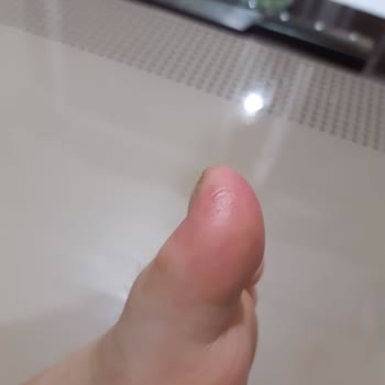 Hepsiburada Sağlıksız Yara Yapan Botlar