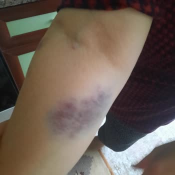 Kocaeli Devlet Hastanesi Annemin MR Randevu Mağduriyeti