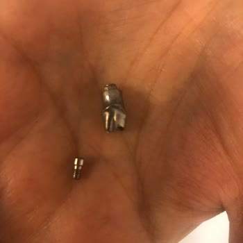 DentaCenter Orijinalliği Şüpheli İmplant Parçası Kullanıp Beni Mağdur Ettiler