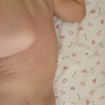 Bioderma Bebek Şampuanı Üretimi Durdurulsun