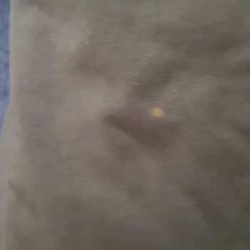 Gant Satın Alınan Tişörtteki Lekeler Ve Müşteri Hizmetleri Sorunu