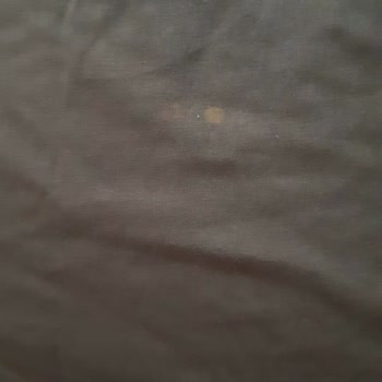 Gant Satın Alınan Tişörtteki Lekeler Ve Müşteri Hizmetleri Sorunu