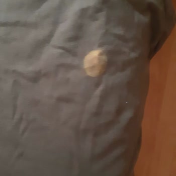 Gant Satın Alınan Tişörtteki Lekeler Ve Müşteri Hizmetleri Sorunu