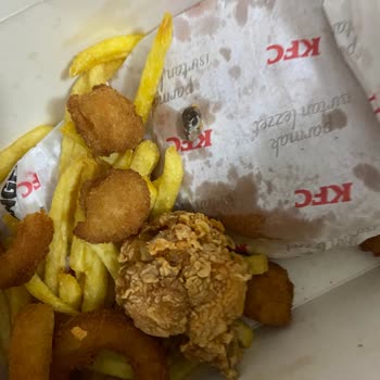 KFC Menüsünün İçinden Yabancı Madde Cıktı!