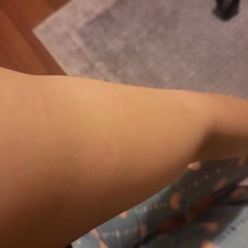 Avon Şampuan Kaşıntı Ve Döküntü