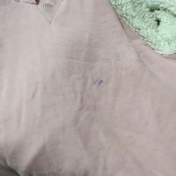 Profilo Leke Sorunu Çıkarmıyor