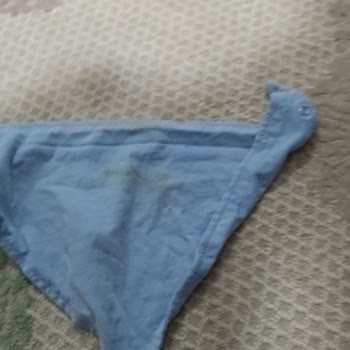 Profilo Leke Sorunu Çıkarmıyor