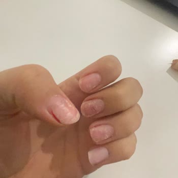 Nascita - Doğuş Kozmetik Tırnaklarım Çıktı Tırnak Yapıştırıcısı Değiş Japon Gibi