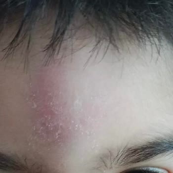 Milli Eğitim Bakanlığı (MEB) Anaokulunda Çocuğa Şiddet